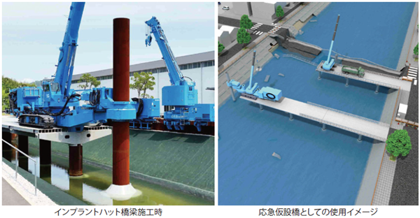インプラントハット橋梁™画像